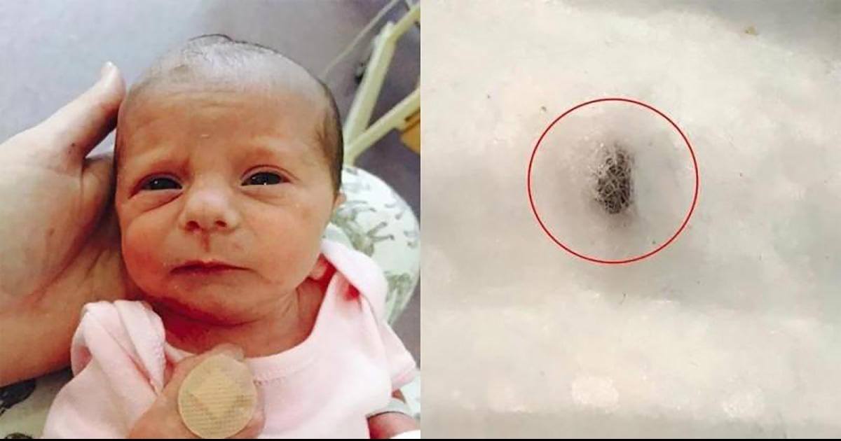 Ce bébé n'arrêtait pas de pleurer, sa mère à fait une découverte en changeant sa couche