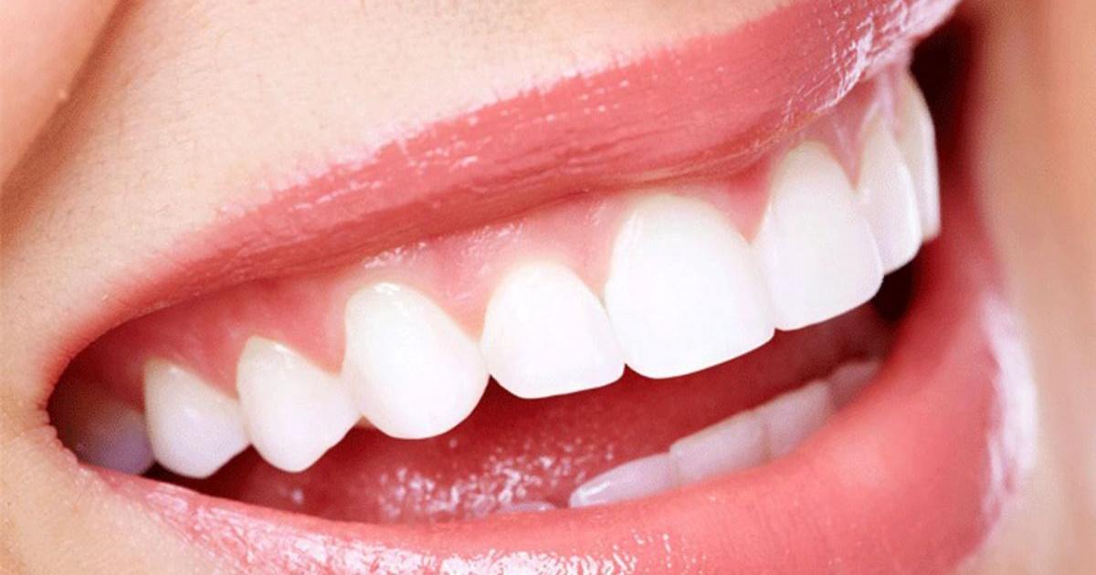 Comment éliminer le tartre des dents rapidement ?