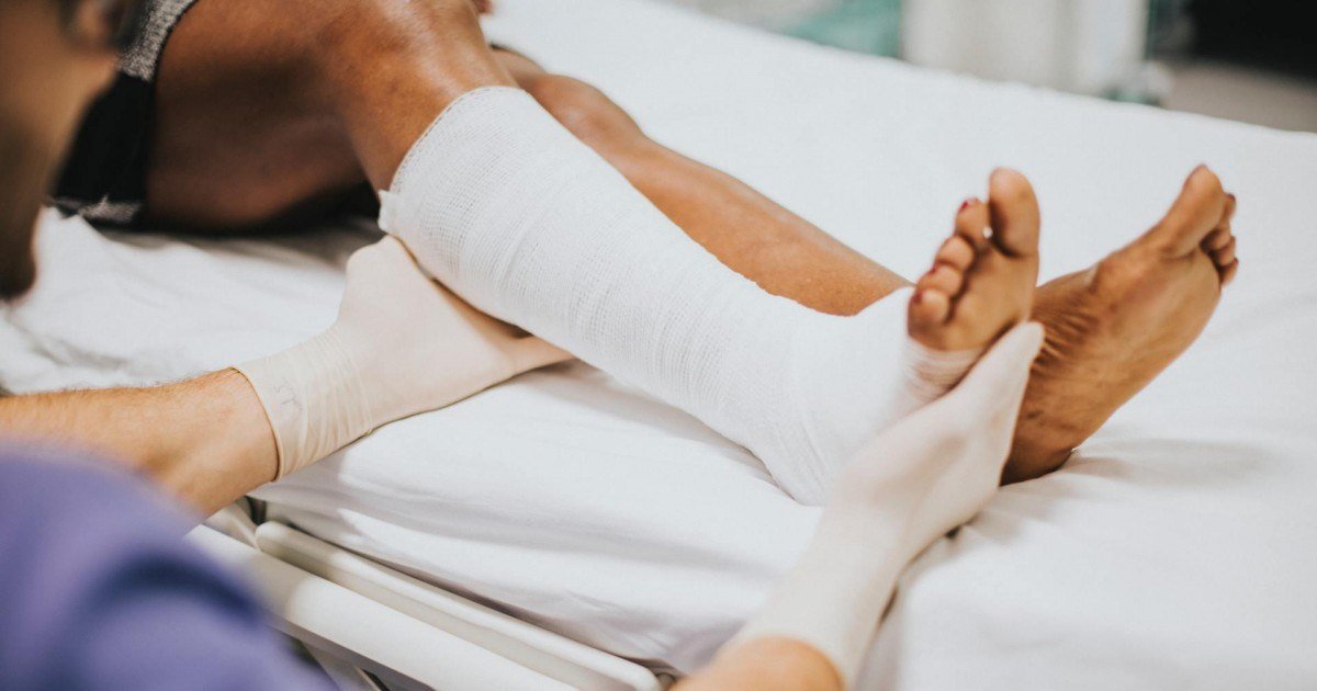 Comment faire pour traiter correctement les problèmes de varices