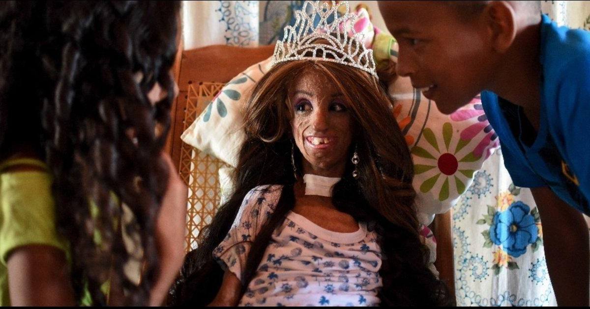 Elle fête ses 15 ans malgré une maladie qui accélère le vieillissement