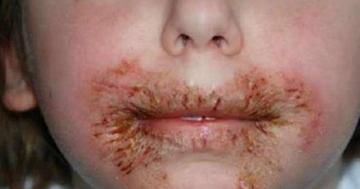 Ne jamais nettoyer le visage des enfants avec des lingettes pour bébé
