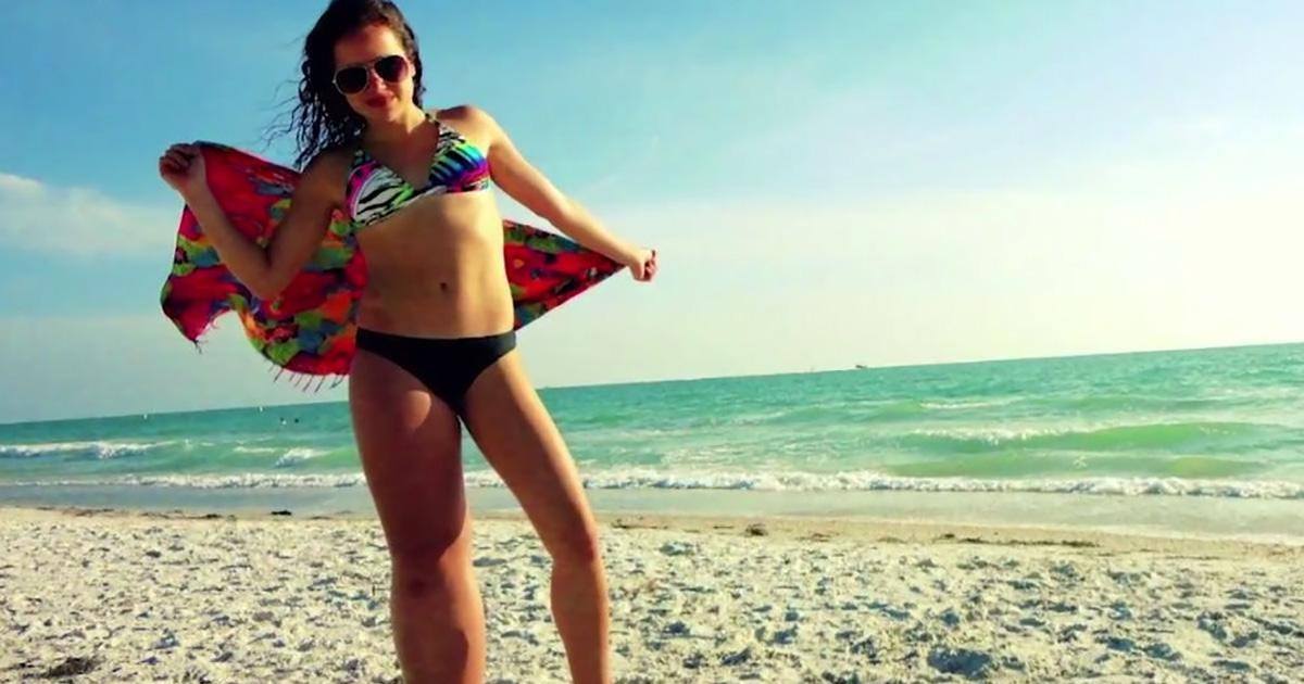 Cette jeune fille arbore fièrement son handicap en posant en bikini !
