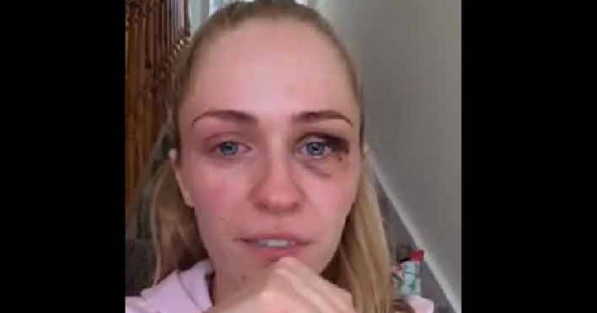 Une maman battue dénonce les violences conjugales dans une vidéo poignante !