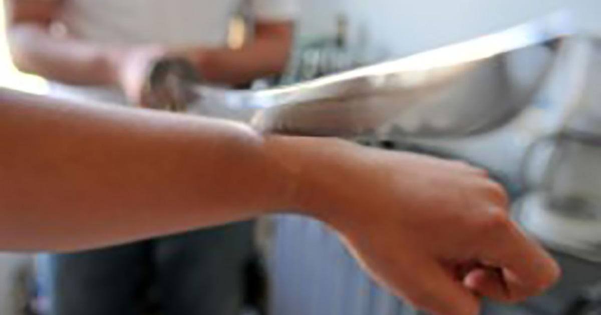 Montélimar : il se fait trancher le bras au sabre pour un sandwich