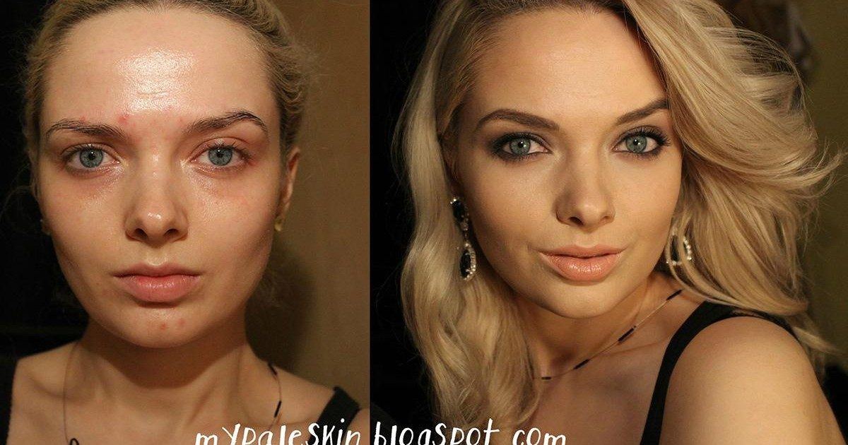 Persécutée pour son acné, cette YouTubeuse beauté répond à ses détracteurs