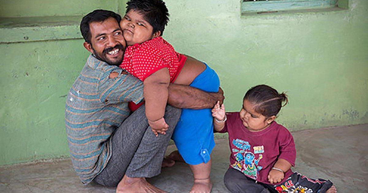 Rameshbhai, le père qui était prêt à vendre son rein pour soigner ses enfants obèses !